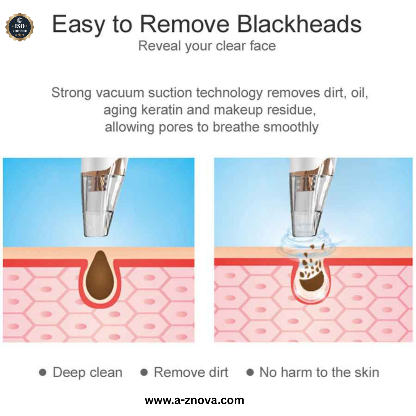 "GlowBoost™ 3-Step Skincare Kit – Deep Pore Cleanser cream + Vacuum Suction + Soft Scrub Brush"